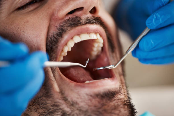 Best Walk-In Emergency Dentist in Bayou Gauche, LA